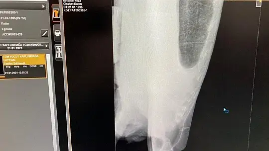 Deniz Kaplumbağalarının rutin bakımları titizlikle yapılıyor