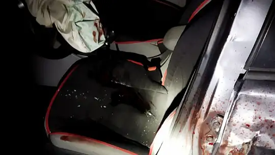 Genç veteriner kazada yaşamını yitirdi