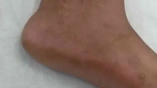 Karşılıklı husumet aileleri dağıttı