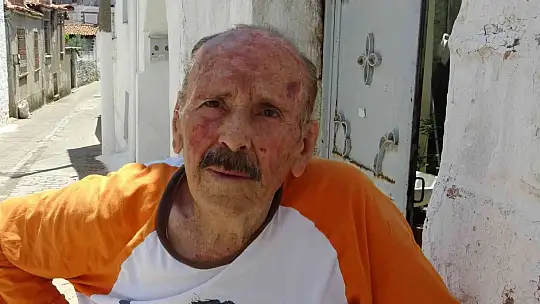 Muğla'da çocuğa köpek saldırısı