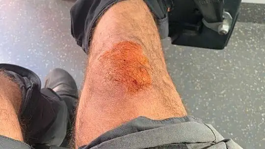 Tabelaya çarpıp ormanlık alana kaçtılar