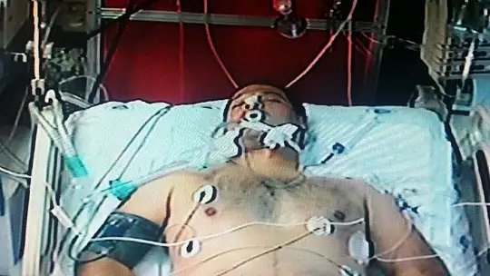 Tam 7 kez ölümden döndü, lakabı 'Kedi' oldu