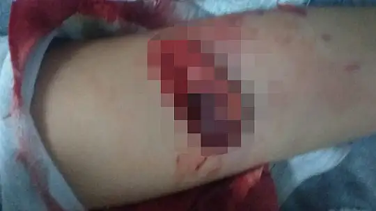 Minik İdil ölümden döndü 