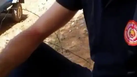 Yaralanan itfaiye eri kendini tedavi ettikten sonra alevlere müdahaleye devam etti