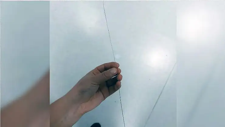 Ayak topuğundan 37 santim tel çıktı