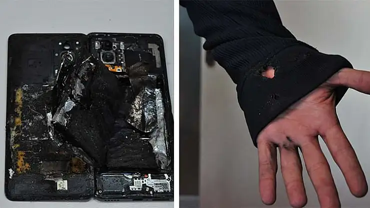 Cep Telefonu Önce Patladı, Sonra Alev Aldı