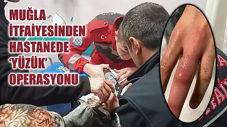 Muğla İtfaiyesinden Hastanede 'Yüzük' Operasyonu