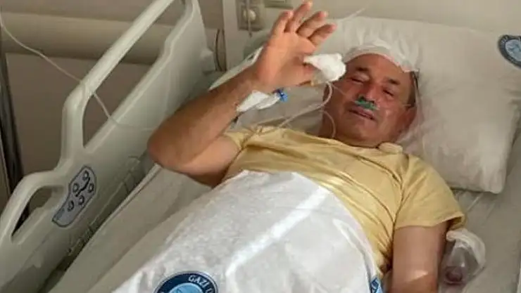 OTGÖZ BEYİN KANAMASI GEÇİRDİ