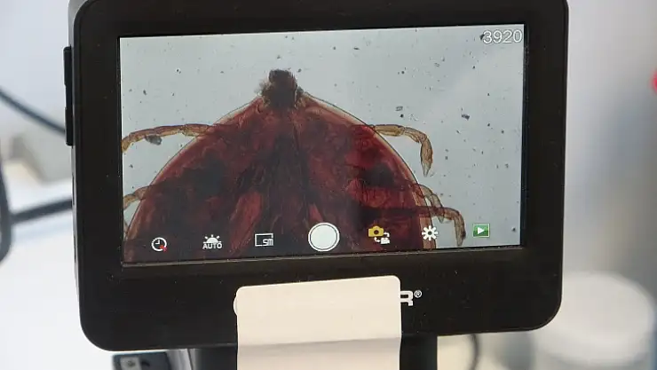 Uyuz Hastalığının Tedavisi Kolaylaştı